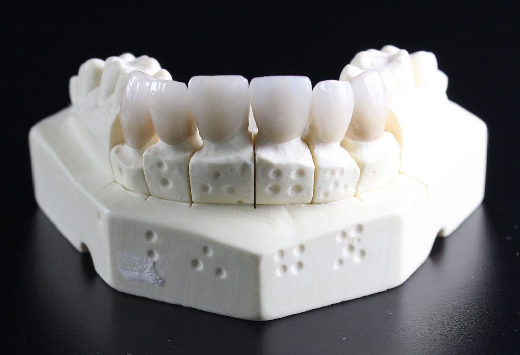 dentures, teeth, dental technician-759929.jpg