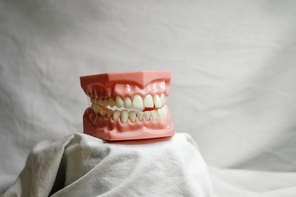teeth, dental, dental model-5522653.jpg